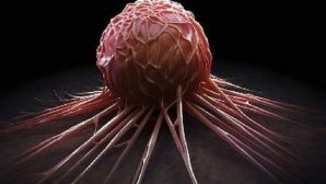 Ученые назвали причину появления неизлечимого рака