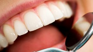 Стоматологи: 15 ошибок из-за которых можно лишиться зубов