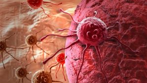 Ученые выяснили, какая группа крови неуязвима перед раком