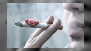 Курение вызывает 90% онкологических заболеваний