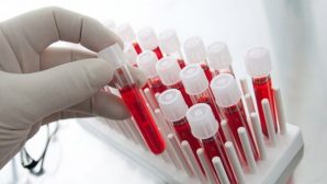 IV группа крови - это настоящая загадка