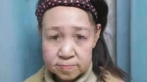 В Китае девочка была вынуждена бросить школу из-за своего лица