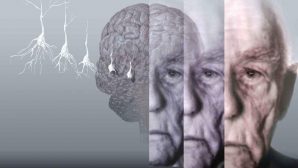 Даже одна бессонная ночь может повысить риск развития болезни Альцгеймера