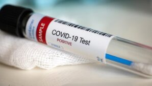 Ученые из США изучают снимки шипов коронавируса COVID-19